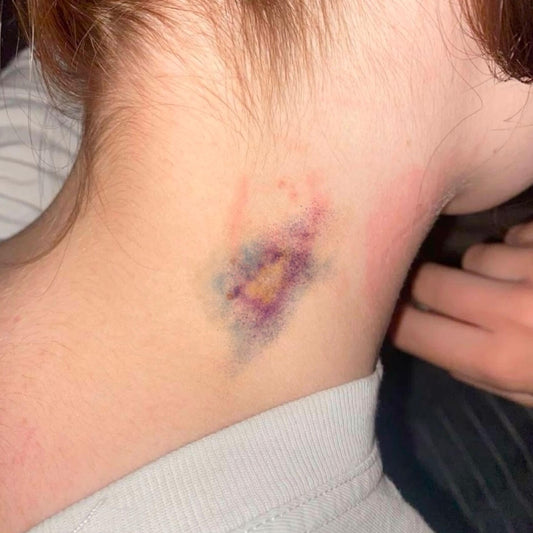 Love Bruise Club Temporary Tattoo