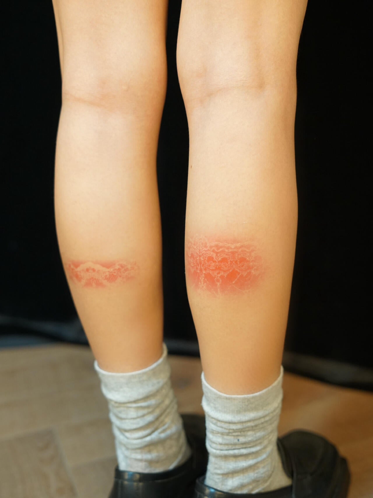 Lace Burn Temporary Tattoo