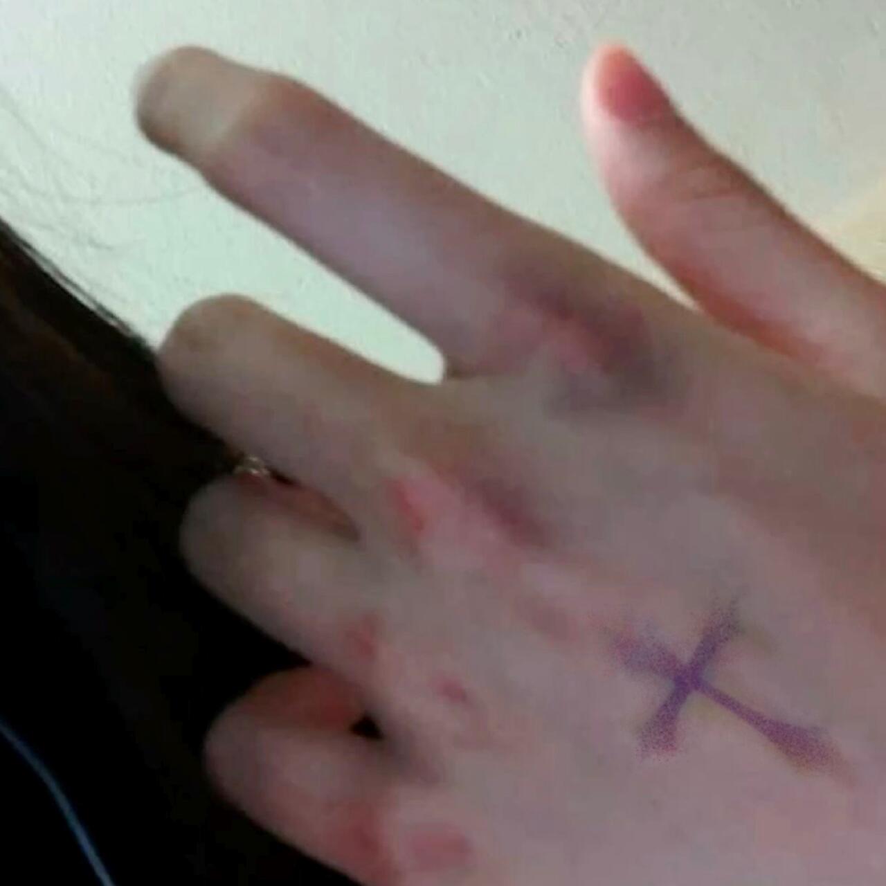 Berry Ouchies Temporary Tattoo
