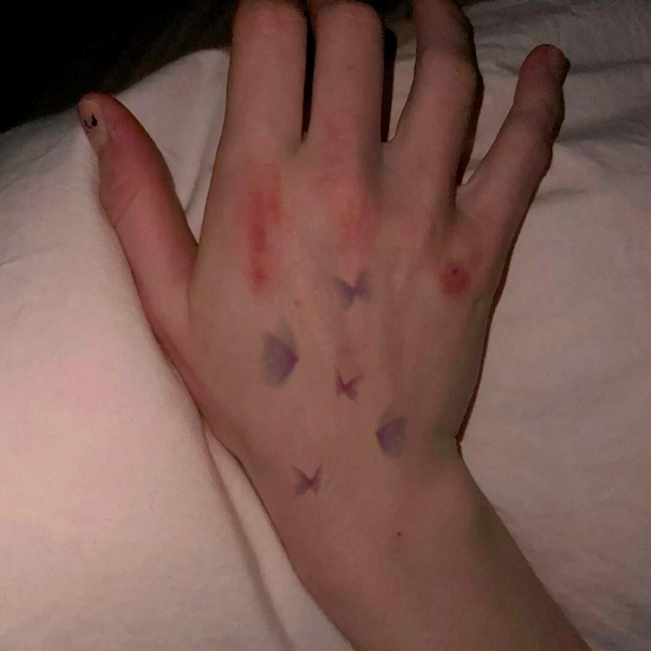 Berry Ouchies Temporary Tattoo