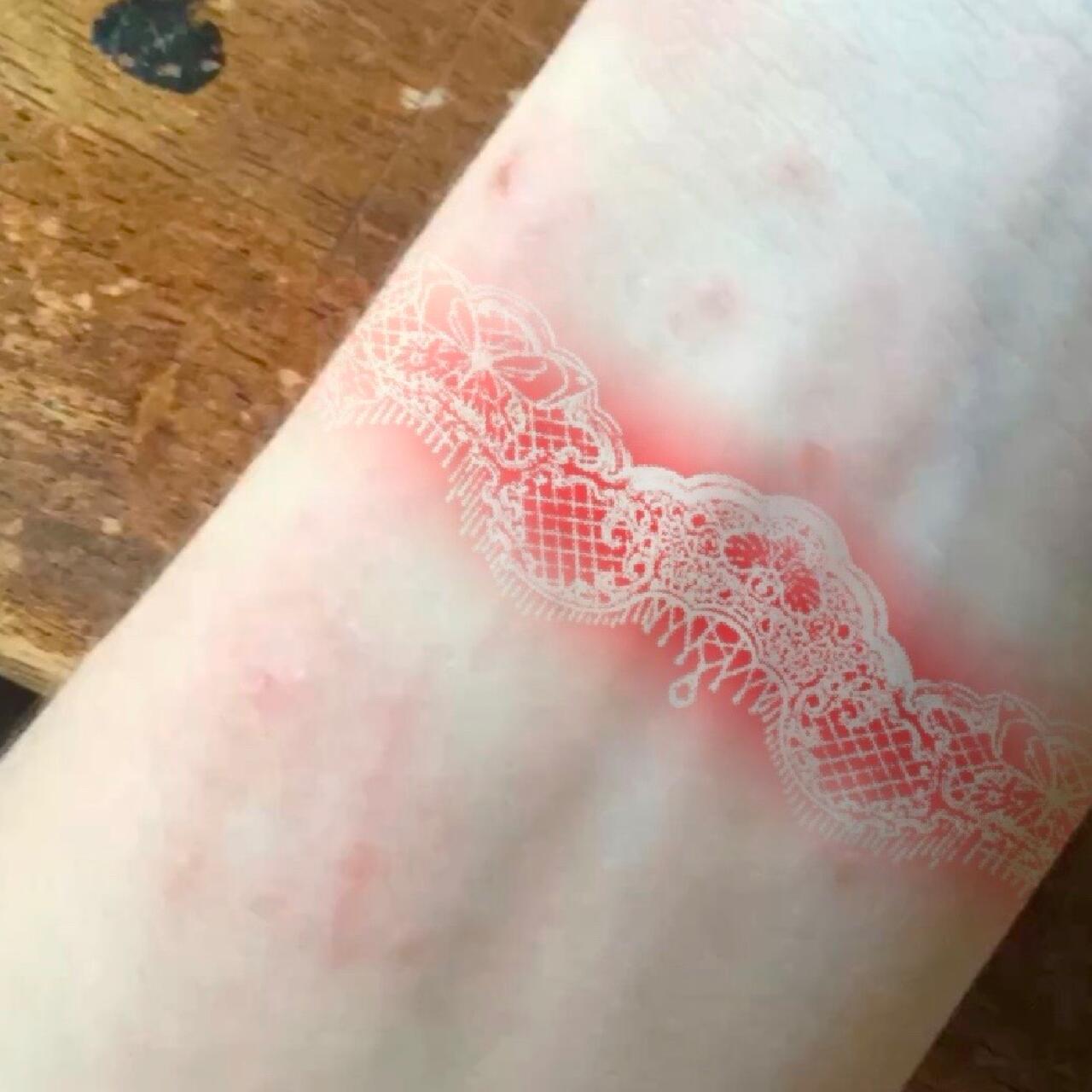 Lace Burn Temporary Tattoo