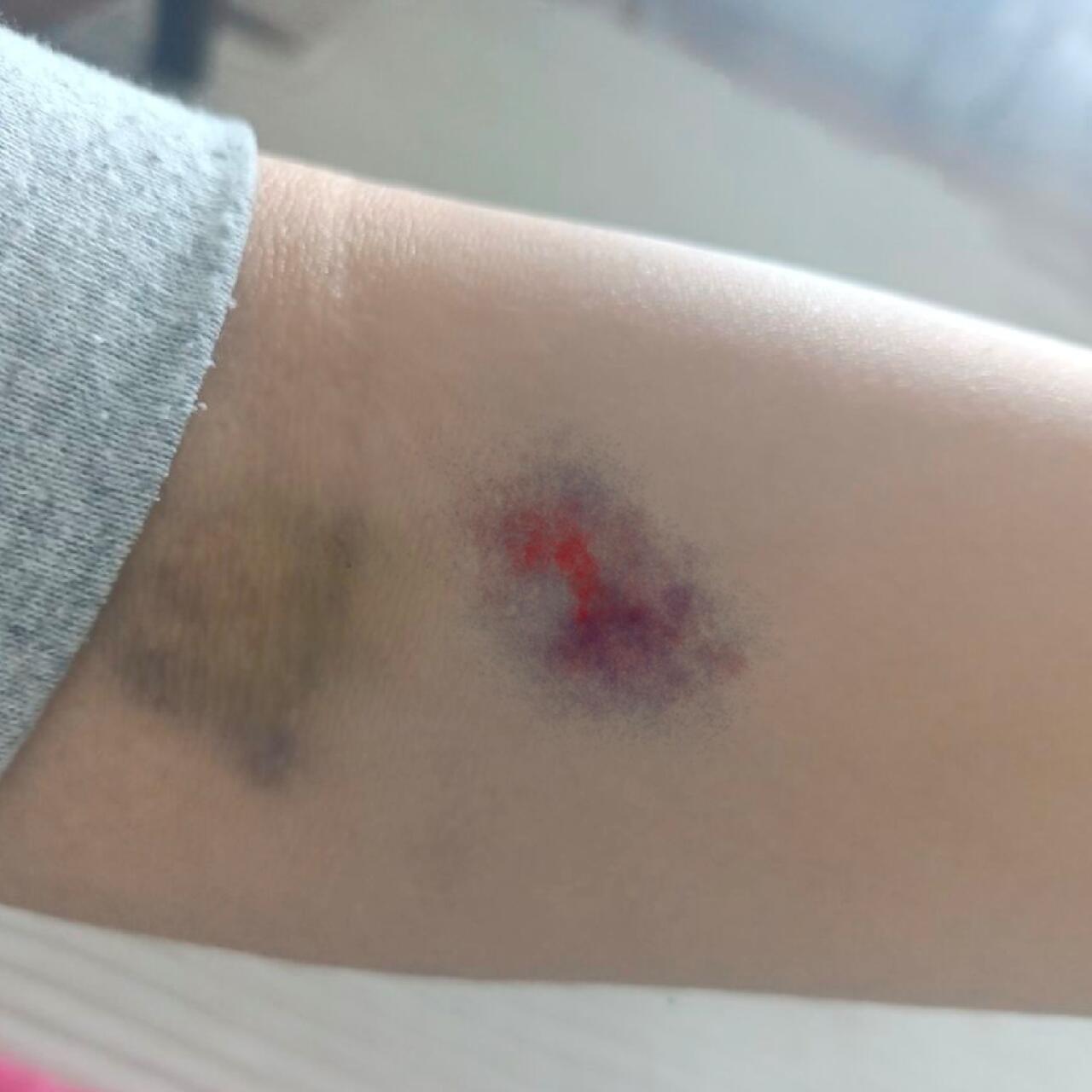 Love Bruise Club Temporary Tattoo