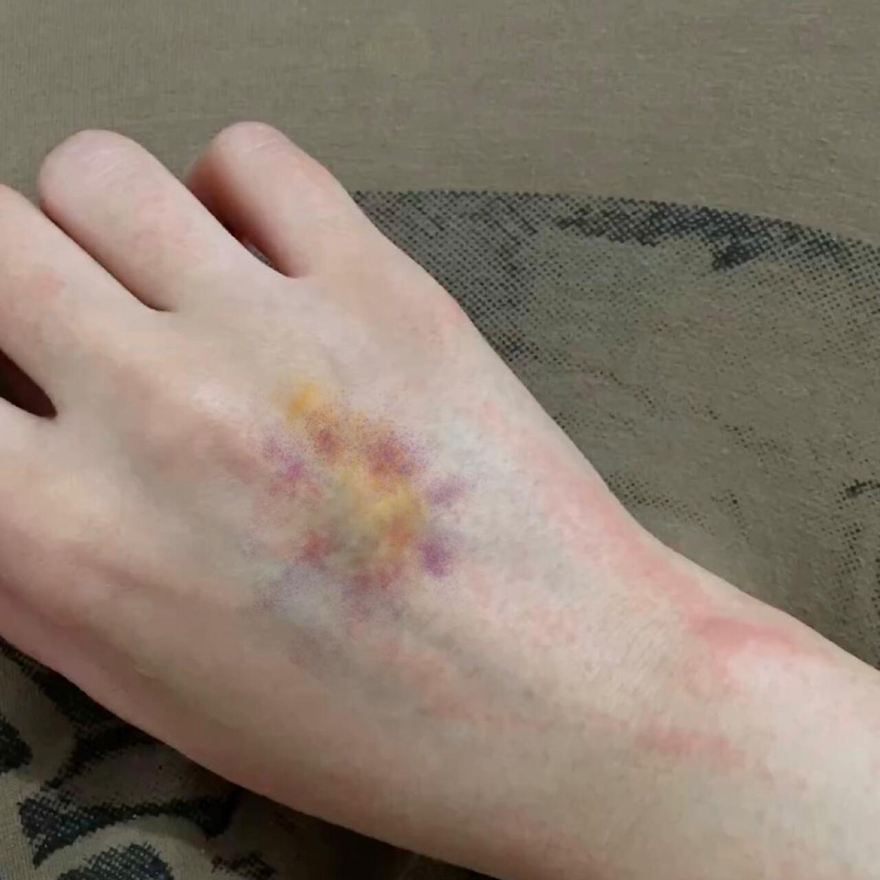 Love Bruise Club Temporary Tattoo