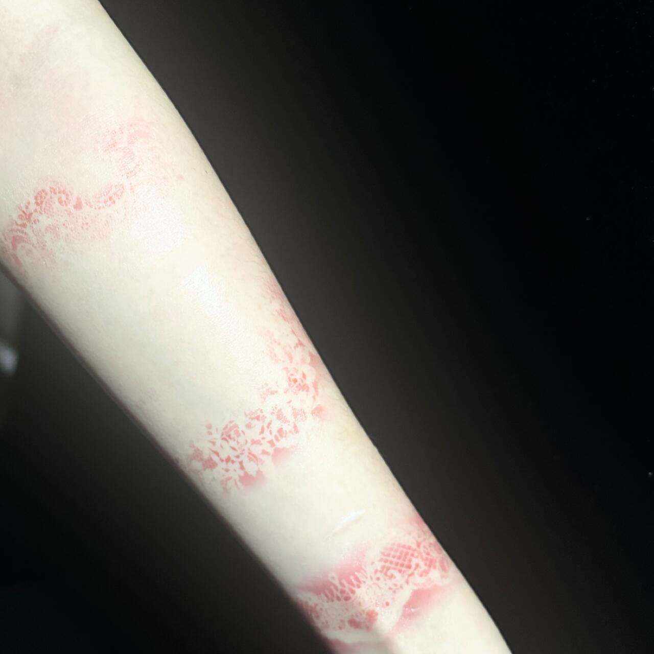 Lace Burn Temporary Tattoo