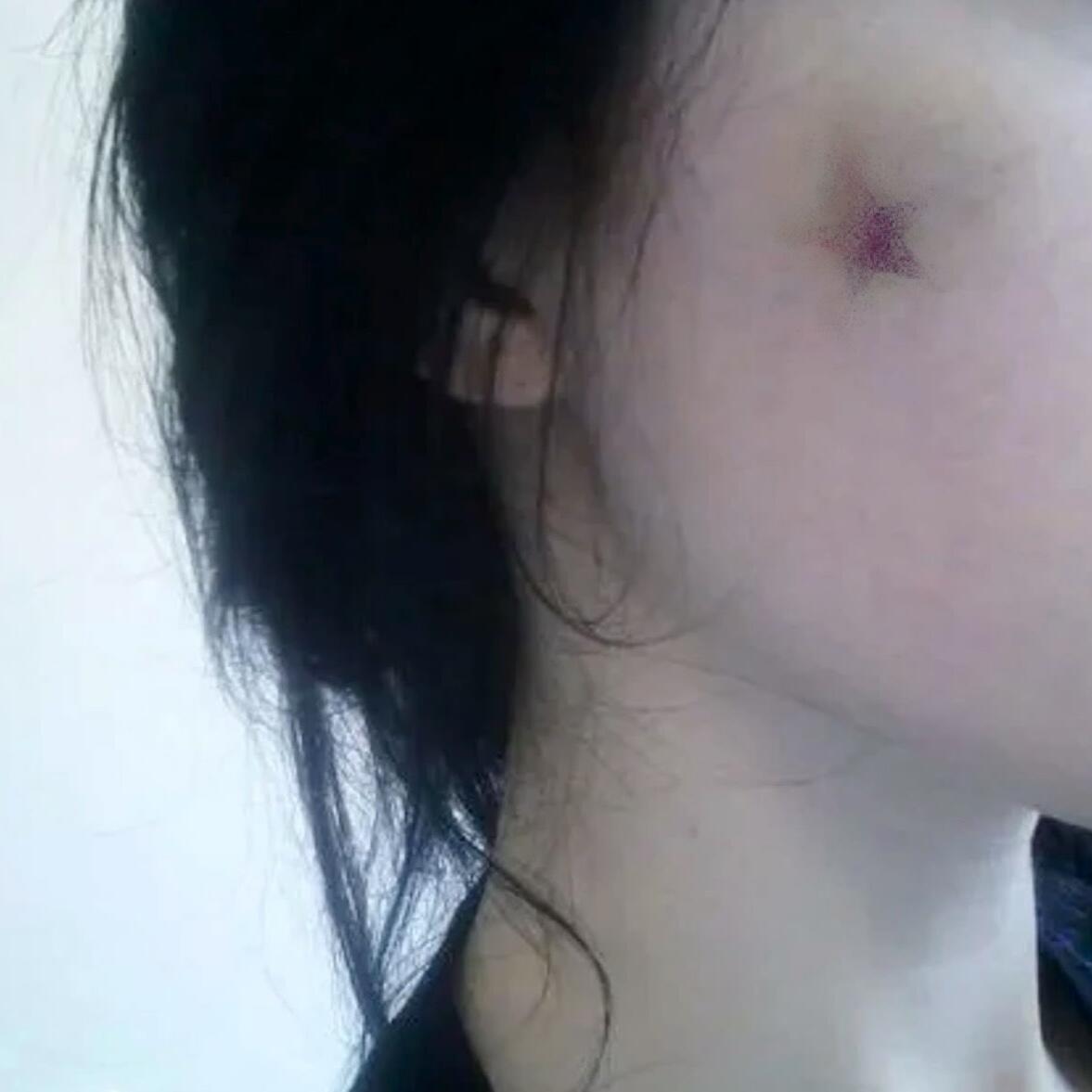Berry Ouchies Temporary Tattoo