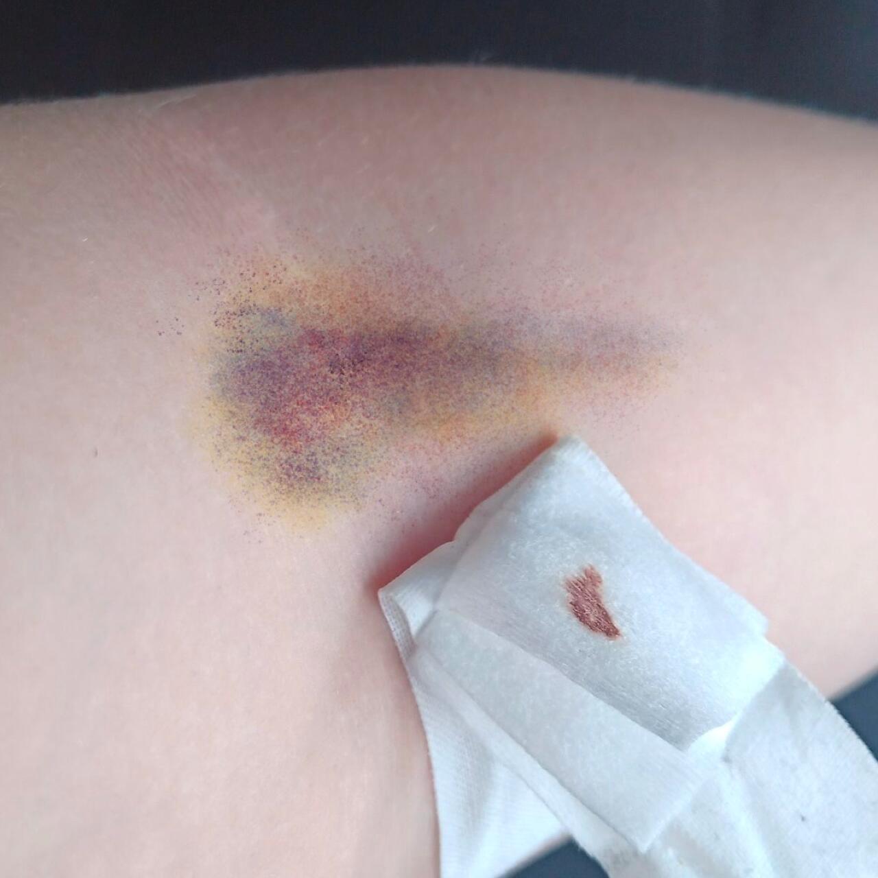 Love Bruise Club Temporary Tattoo