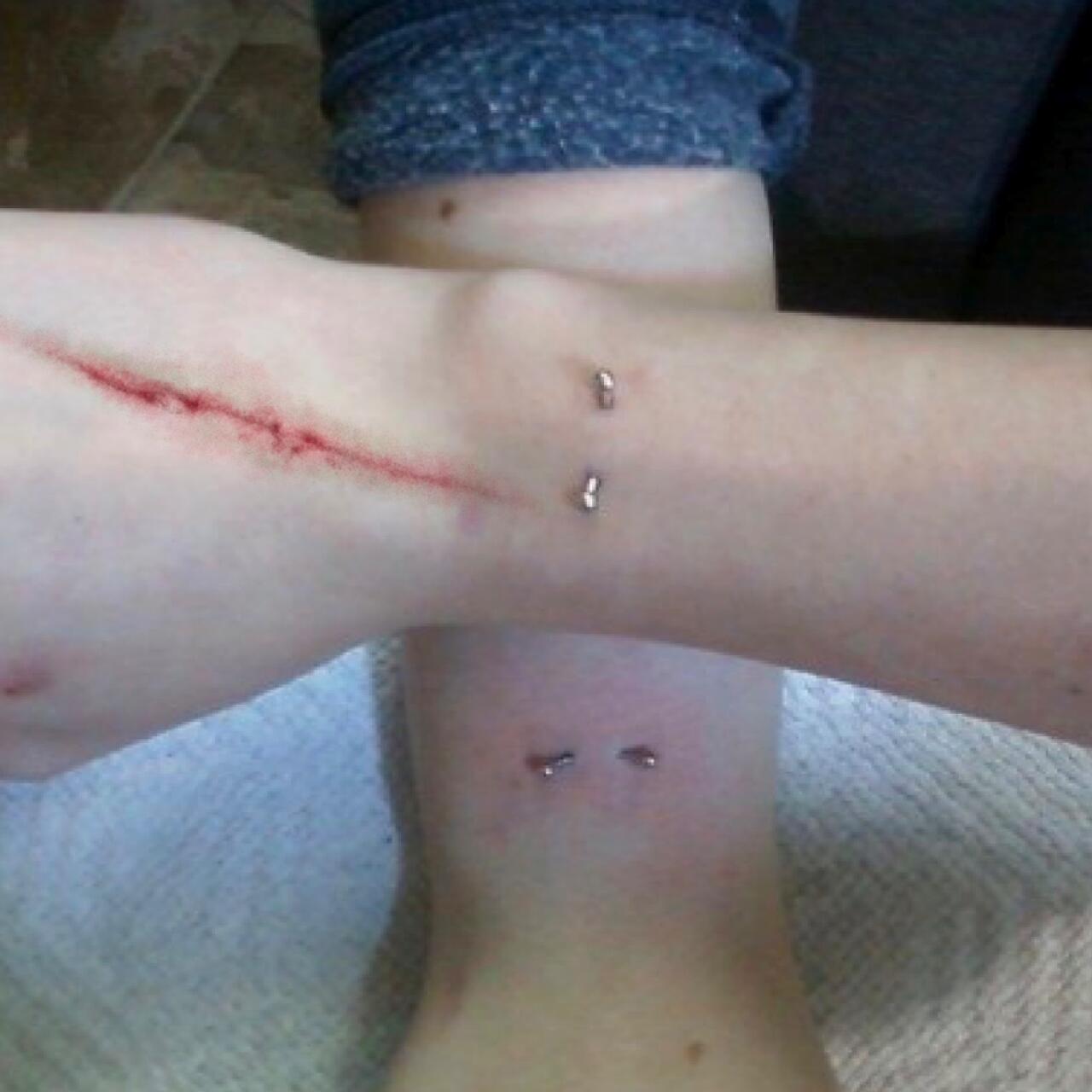 Love Bruise Club Temporary Tattoo